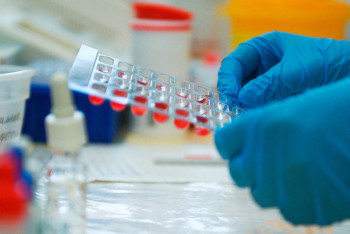 Фотография к новости: 2828 новых случаев КВИ выявили за сутки в Казахстане