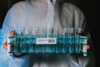 Фотография к новости: 2830 новых случаев КВИ выявили за сутки в Казахстане