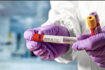 Фотография к новости: Коронавирус диагностирован у 2853 человек за сутки в Казахстане