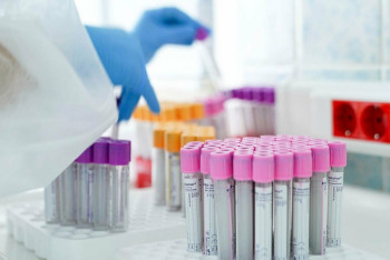 Фотография к новости: Общее число зарегистрированных случаев КВИ превысило 325 000 в Казахстане