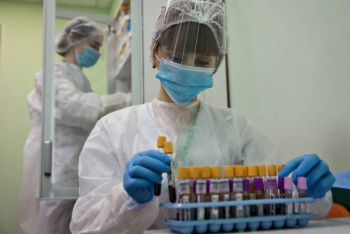 Фотография к новости: 2840 новых случаев КВИ выявили за сутки в Казахстане