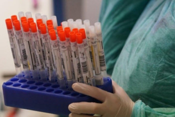 Фотография к новости: 2142 новых случая COVID-19 зарегистрировано за сутки в Казахстане