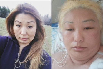 Фотография к новости: После окрашивания волос в салоне красоты жительница Уральска оказалась в реанимации