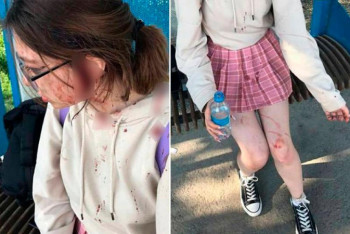 Фотография к новости: Две женщины избили 16-летнюю девушку на остановке в Алматинской области