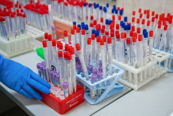 Фотография к новости: Более 2500 человек заболели коронавирусом за сутки в Казахстане