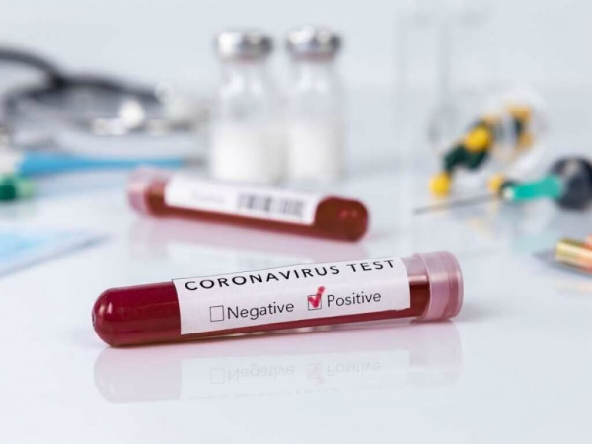 2459 новых случаев коронавируса выявили за сутки в РК