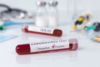 Фотография к новости: 2459 новых случаев коронавируса выявили за сутки в РК