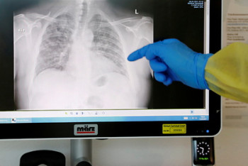 Фотография к новости: Врачи назвали кажущийся "безобидным" симптом рака