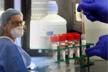 Фотография к новости: 1118 новых случаев COVID-19 выявили за сутки в Казахстане