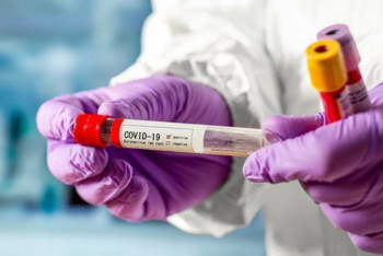 Фотография к новости: 1058 новых случаев коронавируса выявили за сутки в Казахстане