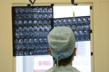 Фотография к новости: Коронавирус способствует исчезновению серого вещества в мозге - исследование