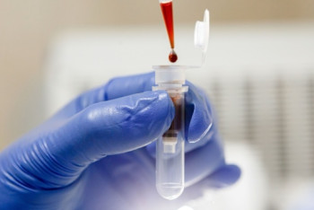 Фотография к новости: О зараженных штаммом "Дельта" в Нур-Султане, рассказали в Минздраве