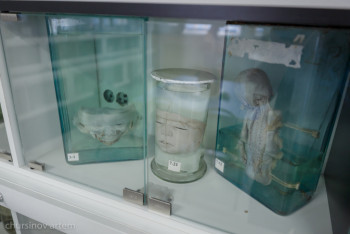 Фотография к новости: Казахстанская кунсткамера неродившихся эмбрионов — фоторепортаж