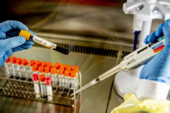 Фотография к новости: В РК за сутки зарегистрировали 1672 новых заболевших COVID-19