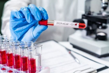 Фотография к новости: 2618 новых случаев коронавируса выявили за сутки в Казахстане