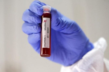 Фотография к новости: За сутки в Казахстане выявлено 3695 заболевших ковидом, 1857 выздоровело