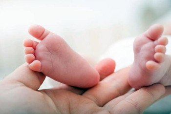 Фотография к новости: Трехглавый младенец появился на свет в Индии