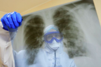 Фотография к новости: Суточный показатель заболеваемости COVID-19 превысил 6600 человек в РК