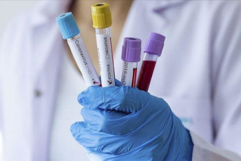 Фотография к новости: Новый антирекорд: 7 749 человек заболели КВИ за сутки в Казахстане