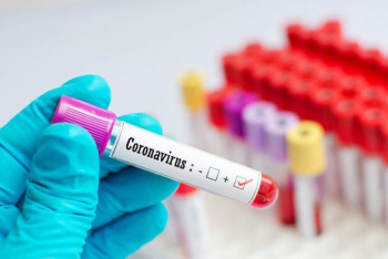 Фотография к новости: Более 7800 новых случаев КВИ зарегистрировали в Казахстане