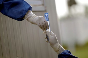 Фотография к новости: Ученые назвали срок сохранения антител к коронавирусу в организме