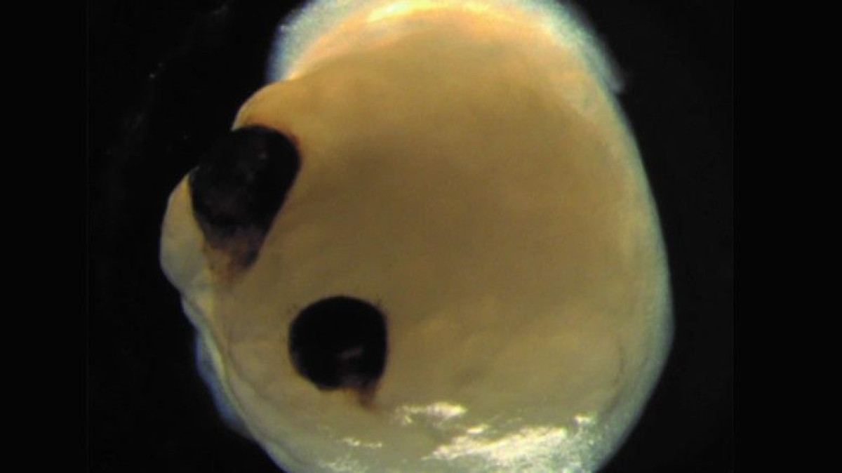 Мини-мозг с глазными. Источник: cell.com