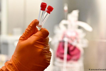 Фотография к новости: Разведка США сообщила новые данные о происхождении коронавируса