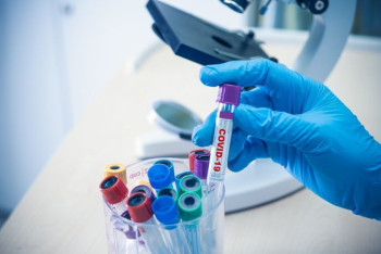 Фотография к новости: Более 6200 новых случаев коронавируса выявили за сутки в Казахстане