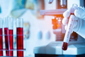 Фотография к новости: За сутки у 5222 человек выявили коронавирус в Казахстане