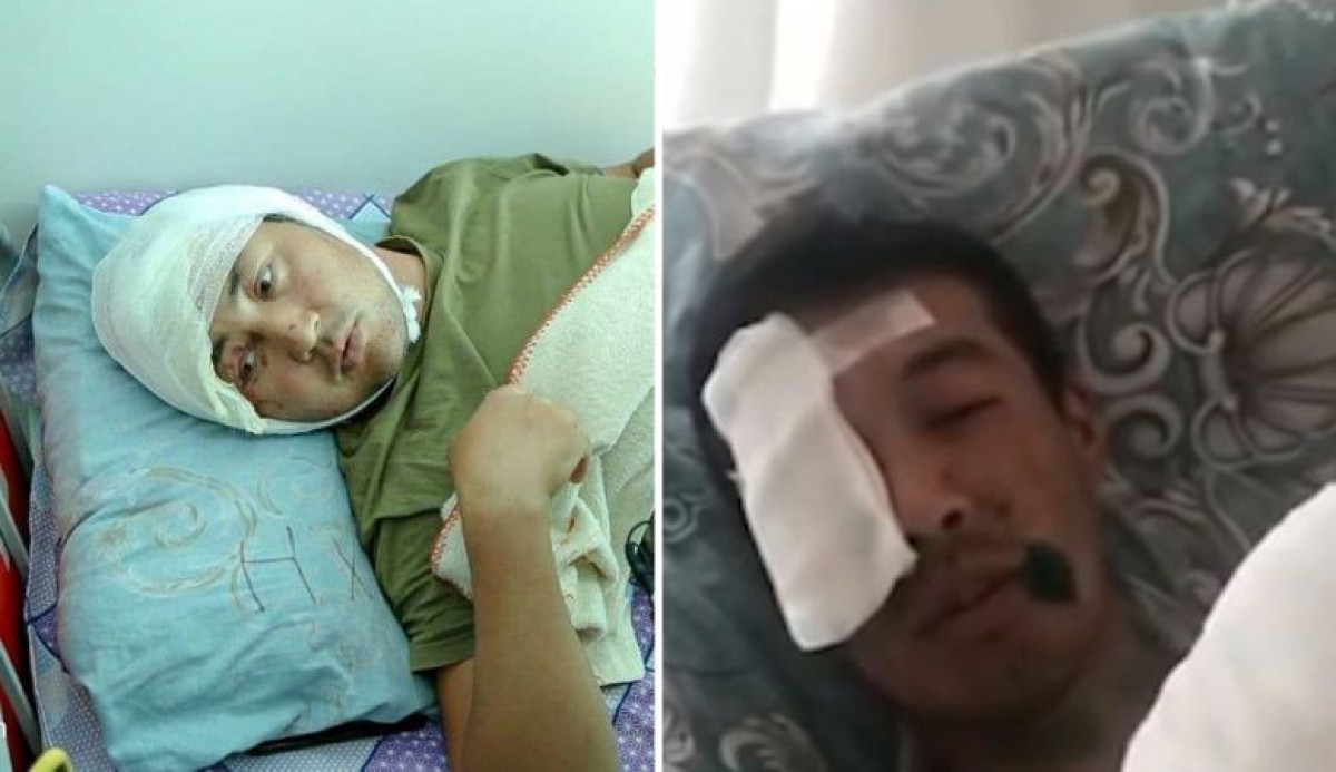 На резонансные интервью пострадавших пожарных ответили в МЧС и Минобороны