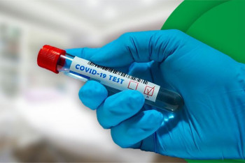 Фотография к новости: 4568 новых случаев коронавируса выявили за сутки в Казахстане