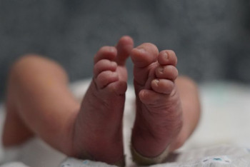 Фотография к новости: В Павлодаре младенец с ковидной пневмонией 28 дней находится в реанимации