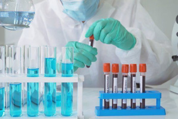 Фотография к новости: Около 3700 новых случаев коронавируса выявили за сутки в Казахстане