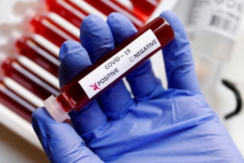 Фотография к новости: 1953 положительных ПЦР зарегистрировали за сутки в Казахстане