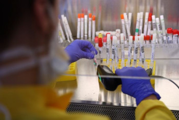 Фотография к новости: 1863 новых случая коронавируса выявили за сутки в Казахстане