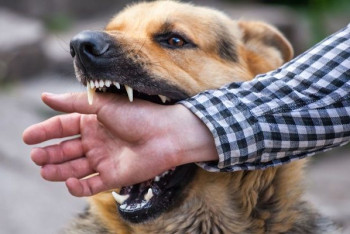 Фотография к новости: 11-летний павлодарский школьник заслонил младшую сестру от напавшей на них собаки