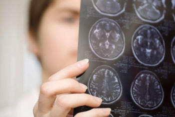 Фотография к новости: Врач назвал необычный симптом рака головного мозга