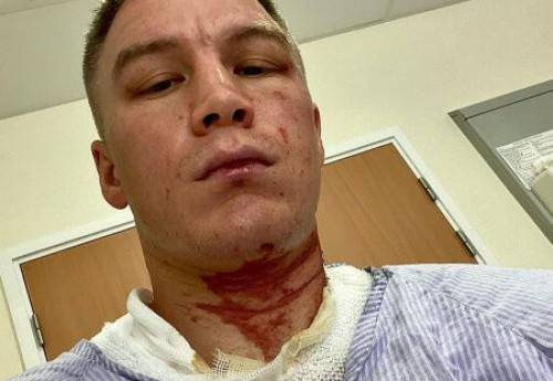 Фотография к новости: Казахстанского боксера облили кислотой на сборах в Англии