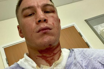 Фотография к новости: Казахстанского боксера облили кислотой: спортсмен рассказал о своем состоянии