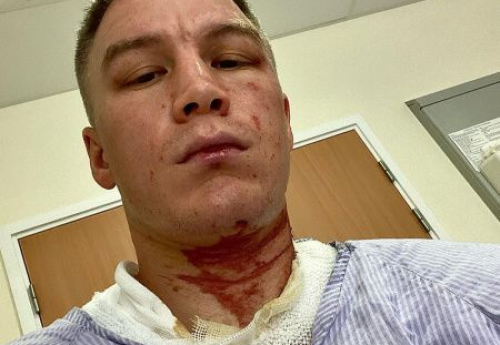 Фотография к новости: Казахстанского боксера облили кислотой: спортсмен рассказал о своем состоянии