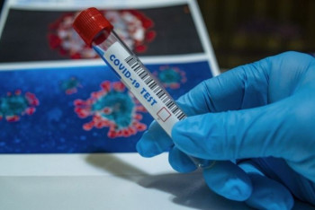 Фотография к новости: 1349 новых случаев коронавируса выявили за сутки в Казахстане