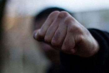 Фотография к новости: Мужчина сломал челюсть ребенку в Коянды