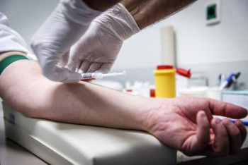 Фотография к новости: Второй в мире пациент излечился от ВИЧ без лекарств