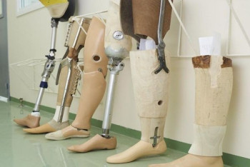 Фотография к новости: На них невозможно ходить: инвалиды жалуются на протезы от государства