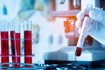 Фотография к новости: 1047 новых случаев коронавируса выявили за сутки в РК