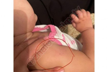 Фотография к новости: Жительница Капшагая заявила, что ее годовалую дочь избили в детсаду