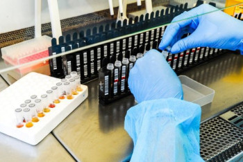 Фотография к новости: Новый штамм коронавируса из Африки назвали "Омикрон"