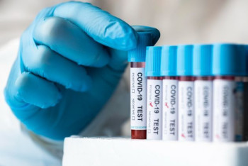 Фотография к новости: Снижение заболеваемости коронавирусом зафиксировано в Казахстане