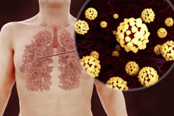 Фотография к новости: COVID-19 может вызвать запуск самоатакующих антител у человека