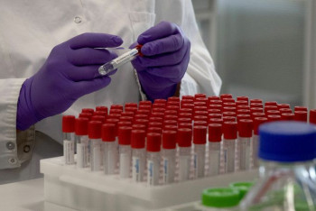 Фотография к новости: Более 12 тысяч новых случаев COVID-19 выявили за сутки в Казахстане